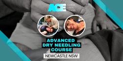 Banner image for Advanced Dry Needling Course (Newcastle NSW)