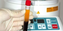 Banner image for Phlebotomy techniques and the process of creating BC-PRP and PRF