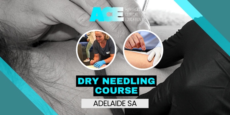 Dry Needling Course (Adelaide SA)