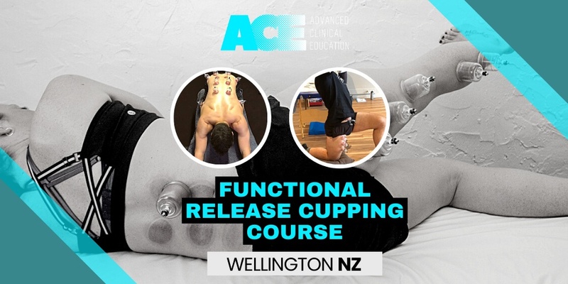 Functional Release Cupping Course (Wellington NZ)