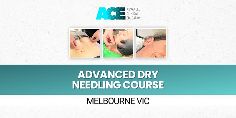 Advanced Dry Needling Course (Melbourne VIC)