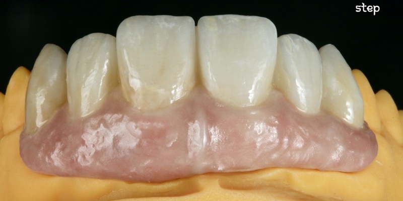 Morphology of AOX Zirconia 2-day hands-on training and hands-free learning.