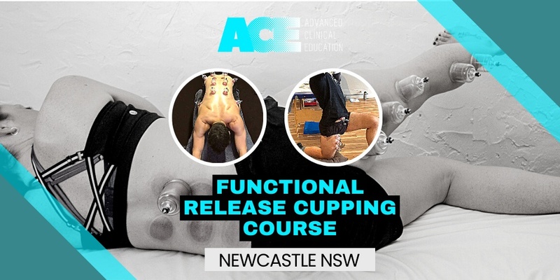 Functional Release Cupping Course (Newcastle NSW)