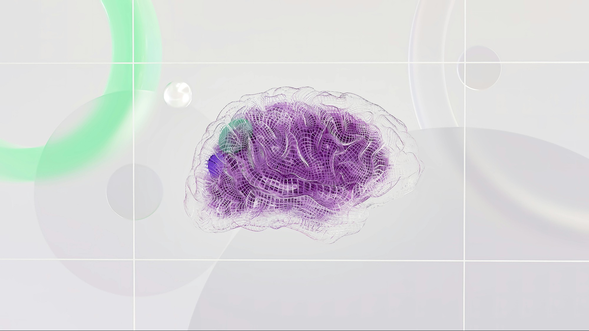 Représentation de la formation : Les Troubles Neurodéveloppementaux (TND)  