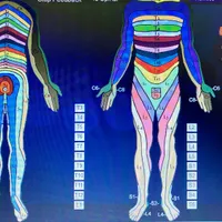 Spinal and Dermatome Profile