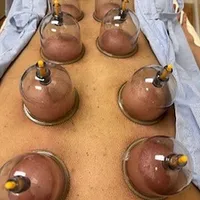 Deluxe Cupping with Consultation