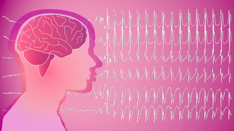 illustration graphique de la formation Neurochirurgie - EEG et SEEG