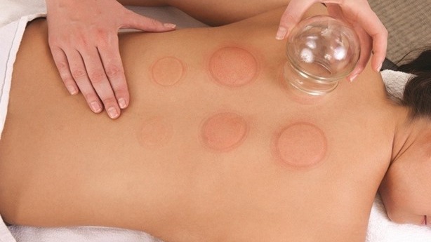 Représentation de la formation : Les ventouses ou cupping - Module 1