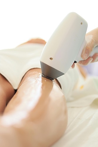 Représentation de la formation : Epilation définitive IPL