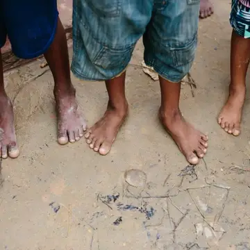 Bare feet of refugee children