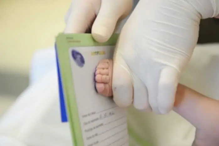 Tomando la muestra del pie de un recién nacido en el hospital.