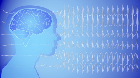 Formation EEG Théorique sur site 3j