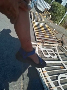 Thumbnail: Four-Year-Old Boy's Foot Crushed by Falling Iron Barrier on C5 - BCDA Taguig