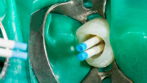 Représentation de la formation : ENDODONTIE Fondamentaux et nouvelles pratiques