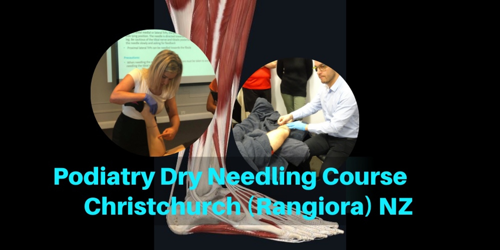 Podiatry Dry Needling Course - Christchurch (Rangiora) NZ