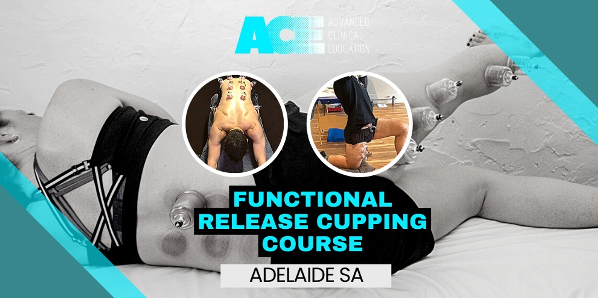Functional Release Cupping Course (Adelaide SA)