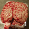 brain1