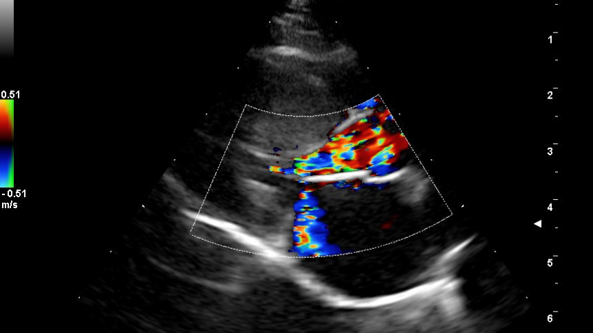 Représentation de la formation : TD classe virtuelle: CAS CLINIQUES Cardiopathies acquises. Diagnostic échographique (2D TM Doppler), traitement.