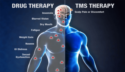 TMS Treatment Breaks Through Resistance for Lasting Relief