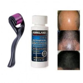 Kirkland Minoxidil 5% With Derma Roller Hair Beard Growth