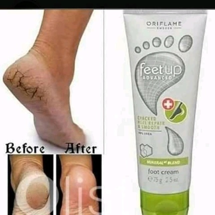 Oriflame feet up on sale advanced cracked heel repair