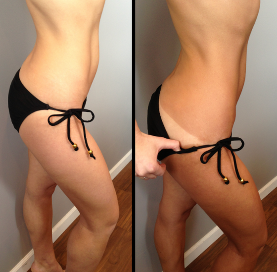 BodyLab Med Spa Spray Tan