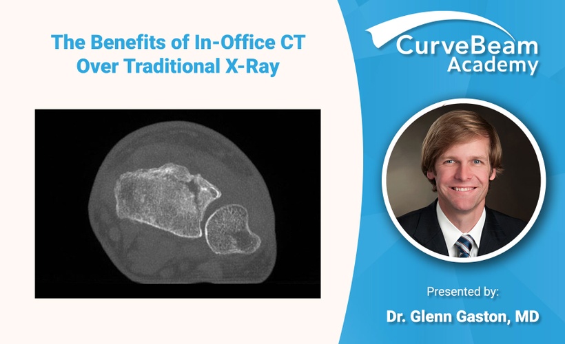 The Benefits of In-Office CT over Traditional X-Ray